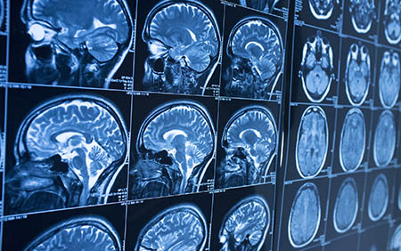 Brain scans of multiple angles and views