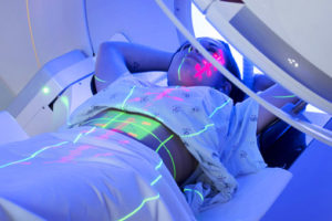 Patient receiving radiation treatment for breast cancer