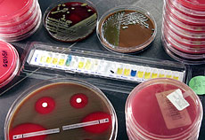 Bacterial culture plates, Organism identification test strip, Antibiotic sensitivity plate (Disk Diffusion Test)