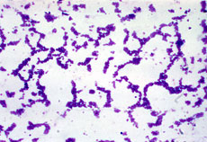 purple bacteria