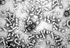 Electron micrograph of hepatatis B viral particles 