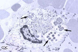 Electronphotomicrograph of morulae in a bone marrow leukocyte in a patient with ehrlichiosis. Arrows indicate individual ehrlichiae. (Source: www.CDC.gov)