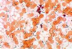 Enterococcus sp. taken from a patient with pneumonia