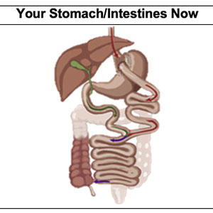 Intestines now